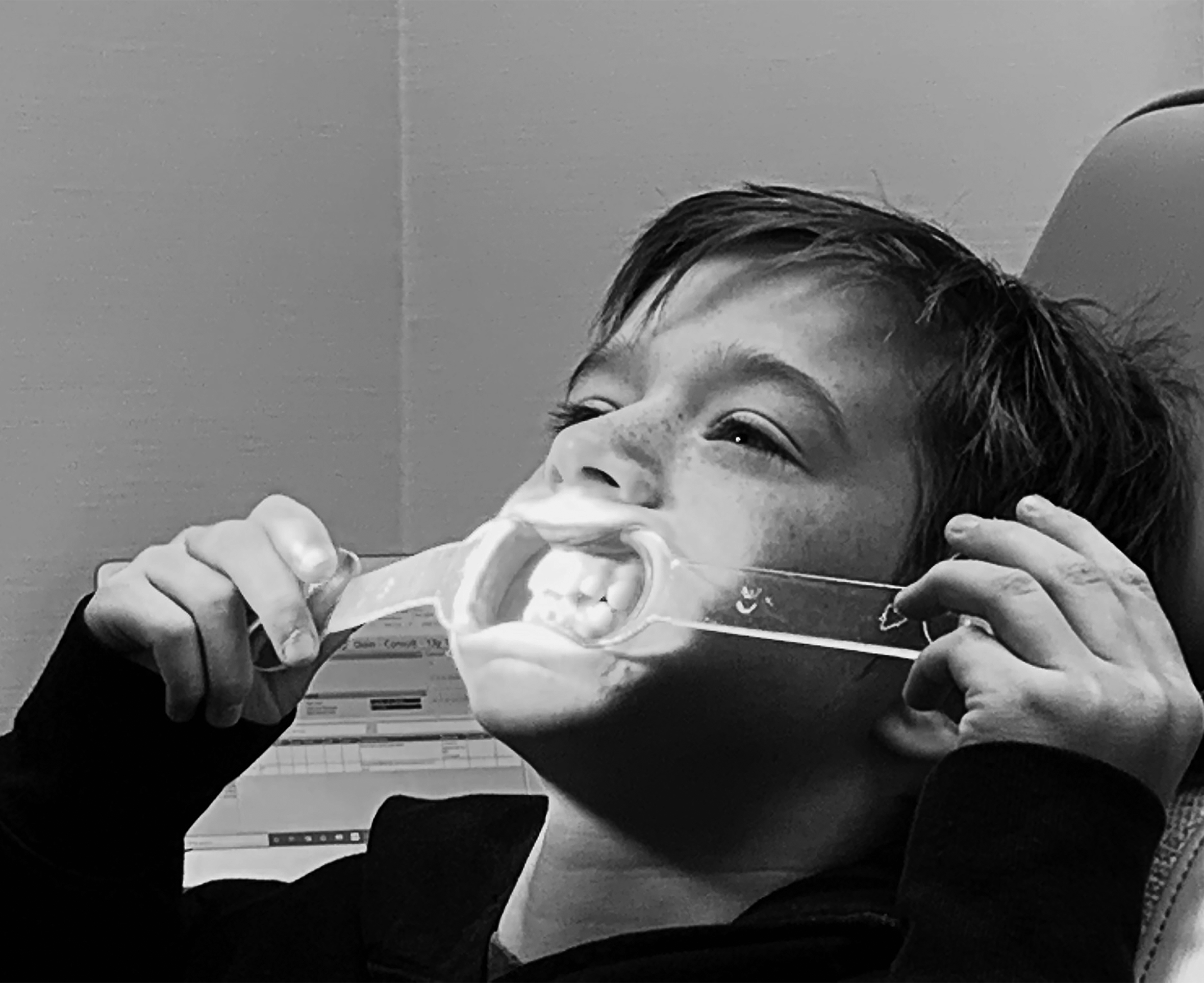 A close-up of a young boy with freckles in a dentist chair. He has a dental mouth opener in his mouth and is holding the sides with his hands.